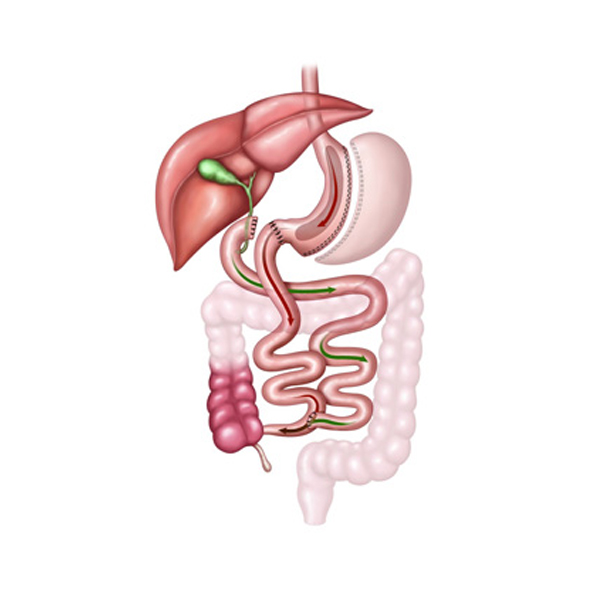 Cirurgia Bari trica Sander Medical Center